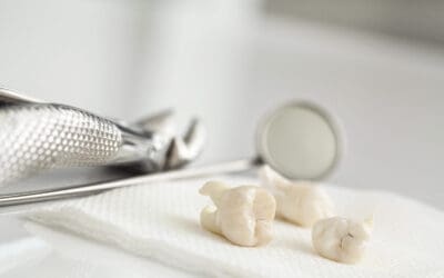 Wisdom Tooth Extraction Recovery Tips & Timeline